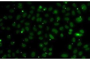Immunofluorescence analysis of A549 cells using NSL1 Polyclonal Antibody (NSL1 anticorps)
