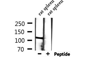 Western blot analysis of extracts from rat spleen, using MCM2 Antibody. (MCM2 anticorps  (N-Term))