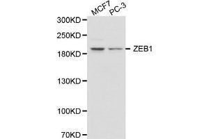Western blot analysis of MCF7 cell and PC-3 cell lysate using ZEB1 antibody.