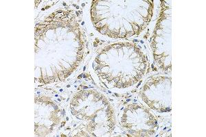 Immunohistochemistry of paraffin-embedded human stomach using HPS1 antibody at dilution of 1:100 (x40 lens). (HPS1 anticorps)