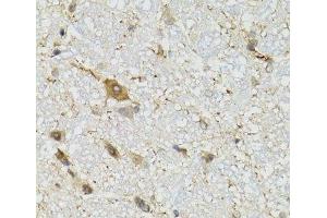 Immunohistochemistry of paraffin-embedded Mouse brain using COQ3 Polyclonal Antibody at dilution of 1:100 (40x lens). (COQ3 anticorps)