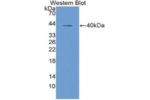 Detection of Recombinant IGF1, Human using Polyclonal Antibody to Insulin Like Growth Factor 1 (IGF1) (IGF1 anticorps  (AA 49-118))