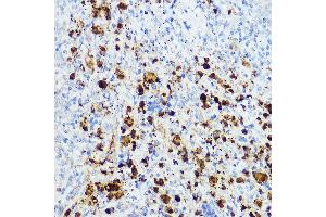 Immunohistochemistry of paraffin-embedded mouse spleen using Hivep3 Rabbit pAb (ABIN7267792) at dilution of 1:50 (40x lens). (Human Immunodeficiency Virus Type I Enhancer Binding Protein 3 (HIVEP3) anticorps)