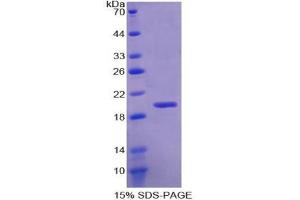 SDS-PAGE analysis of Human RBM20 Protein. (RBM20 Protéine)