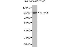 Western Blotting (WB) image for anti-RAS P21 Protein Activator (GTPase Activating Protein) 1 (RASA1) (AA 140-220) antibody (ABIN6218715) (RASA1 anticorps  (AA 140-220))