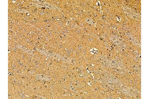ABIN7095633 and ABIN7099695 at 1/100 staining rat brain tissue by IHC-P. (POU6F1 anticorps)