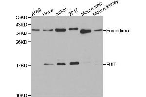Western blot analysis of extracts of various cell lines, using FHIT antibody. (FHIT anticorps)
