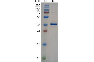 Human NEFL(89-400) Protein, His Tag on SDS-PAGE under reducing condition.