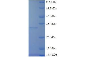 Tryptase beta 2 (Gene/pseudogene) (TPSB2) (AA 30-274) protein (His tag) expressed in E.