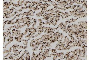ABIN6279212 at 1/100 staining Human lung tissue by IHC-P. (PDE1A anticorps  (Internal Region))