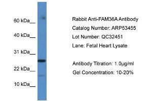 WB Suggested Anti-FAM36A Antibody Titration: 0. (FAM36A anticorps  (C-Term))