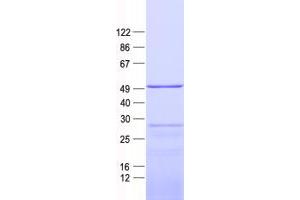 Validation with Western Blot
