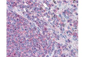 IHC-P Image Immunohistochemical analysis of paraffin-embedded human Spleen, using gamma Actin, antibody(10 μg/ml).