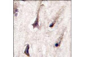 Formalin-fixed and paraffin-embedded human brain tissue reacted with PKC beta2 antibody (C-term), which was peroxidase-conjugated to the secondary antibody, followed by DAB staining. (PKC beta anticorps  (C-Term))