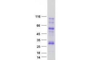 Validation with Western Blot