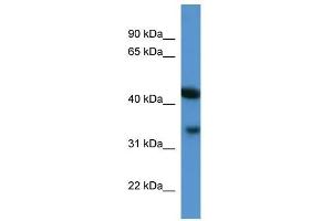 Centa1 antibody used at 0. (ADAP1 anticorps  (C-Term))