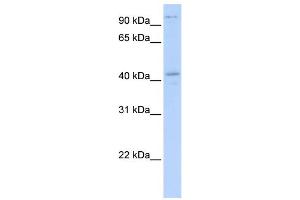 WB Suggested Anti-FGD1 Antibody Titration:  0.