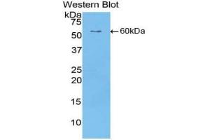 Western blot analysis of the recombinant protein. (CILP anticorps  (AA 603-846))