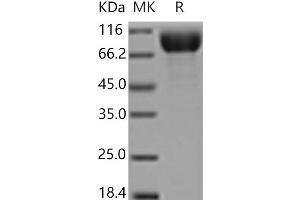 Western Blotting (WB) image for Platelet Derived Growth Factor Receptor alpha (PDGFRA) protein (His tag) (ABIN7321081)