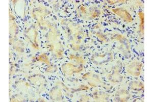 Immunohistochemistry of paraffin-embedded human kidney tissue using ABIN7146856 at dilution of 1:100 (CSNK1A1L anticorps  (Isoform alpha))