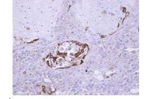 Figure 2. (SOCS5 anticorps  (N-Term))