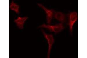 ABIN6275001 staining COLO205 by IF/ICC.