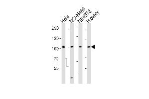 Western blot analysis of lysates from Hela, NCI-H460, mouse NIH/3T3 cell line and human ovary tissue lysate (from left to right), using EPHA4 Antibody (R890) at 1:1000 at each lane. (EPH Receptor A4 anticorps  (C-Term))