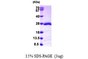 SDS-PAGE (SDS) image for RAP1B, Member of RAS Oncogene Family (RAP1B) (AA 1-181) protein (His tag) (ABIN667867)