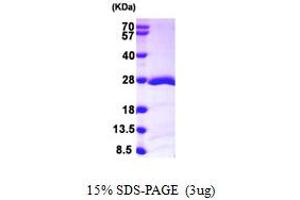 SDS-PAGE (SDS) image for RAP1B, Member of RAS Oncogene Family (RAP1B) (AA 1-181) protein (His tag) (ABIN667867)