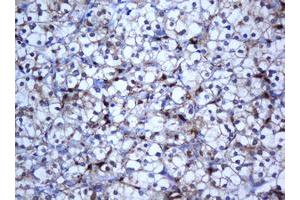 Image no. 3 for anti-Selenium Binding Protein 1 (SELENBP1) antibody (ABIN1500860)