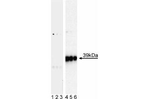 Western blot analysis of c-Jun (pS63) in human vascular endothelium. (C-JUN anticorps  (pSer63))