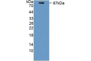 Detection of Recombinant PCSK9, Mouse using Polyclonal Antibody to Proprotein Convertase Subtilisin/Kexin Type 9 (PCSK9) (PCSK9 anticorps  (AA 156-694))