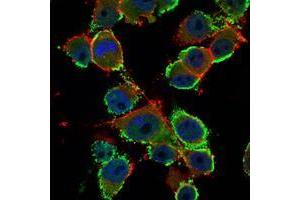 Immunofluorescence analysis of PANC-1 cells using CEA mouse mAb (green). (CEA anticorps)