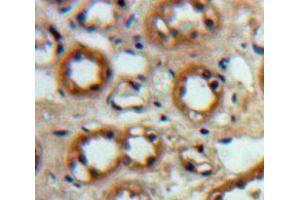 Used in DAB staining on fromalin fixed paraffin-embedded Kidney tissue (IGF1R anticorps  (AA 763-955))