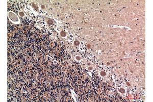 Immunohistochemistry (IHC) analysis of paraffin-embedded Human Brain, antibody was diluted at 1:100.