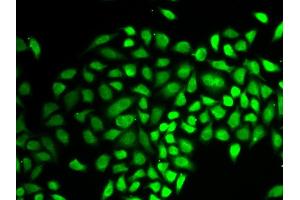 Immunofluorescence analysis of HeLa cell using USP7 antibody. (USP7 anticorps  (AA 206-1102))