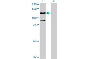 Western Blot analysis of STK31 expression in transfected 293T cell line by STK31 monoclonal antibody (M02), clone 1C10. (STK31 anticorps  (AA 920-1019))