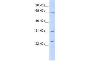 WB Suggested Anti-EME1 Antibody Titration: 0. (Crossover junction endonuclease EME1 (EME1) (N-Term) anticorps)