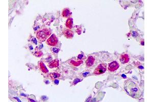 anti-Tumor Necrosis Factor (Ligand) Superfamily, Member 10 (TNFSF10) antibody