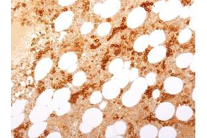 Formalin-fixed, paraffin-embedded human Bone Marrow stained with CD71 Mouse Monoclonal Antibody (TFRC/1817).