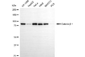Western blotting analysis using catenin beta 1 antibody (ABIN7797928).