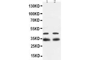 Western Blotting (WB) image for anti-SRY (Sex Determining Region Y)-Box 2 (SOX2) (AA 171-183), (Middle Region) antibody (ABIN3044477) (SOX2 anticorps  (Middle Region))