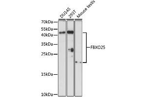 Western blot analysis of extracts of various cell lines, using FBXO25 antibody (ABIN6292075) at 1:1000 dilution. (FBXO25 anticorps)