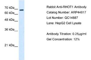 Western Blotting (WB) image for anti-Ras Homolog Gene Family, Member T1 (RHOT1) (N-Term) antibody (ABIN310631) (RHOT1 anticorps  (N-Term))