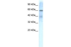 Western Blotting (WB) image for anti-Potassium Voltage-Gated Channel, Shal-Related Subfamily, Member 3 (KCND3) antibody (ABIN2461109) (KCND3 anticorps)