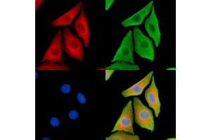 ABIN7095333 and ABIN7099390 staining Hela cells by IF/ICC. (COPA anticorps)