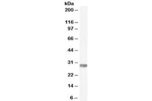 Western blot testing of human kidney lysate with CLIC4 antibody at 0. (CLIC4 anticorps)