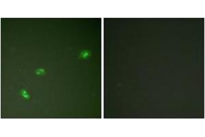 Immunofluorescence analysis of HeLa cells treated with EGF 200nM 5', using NPM (Phospho-Thr199) Antibody.
