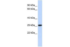 SDHB antibody used at 1 ug/ml to detect target protein. (SDHB anticorps)