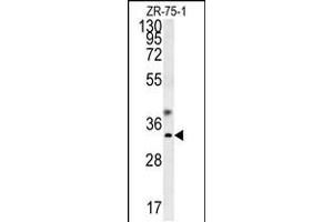Western blot analysis in ZR-75-1 cell line lysates (35ug/lane). (GCH1 anticorps  (N-Term))
